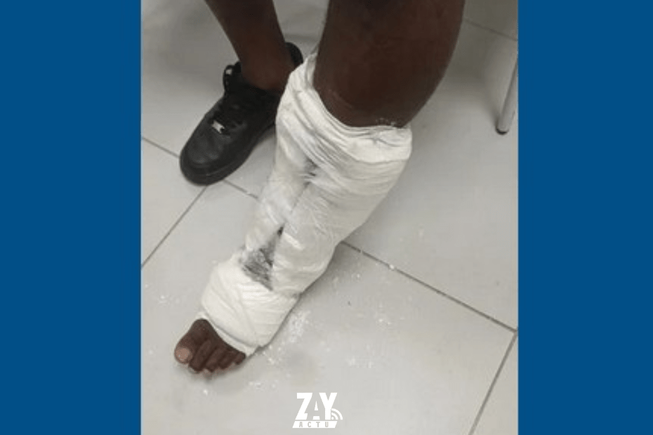 Faux plâtre cocaïne