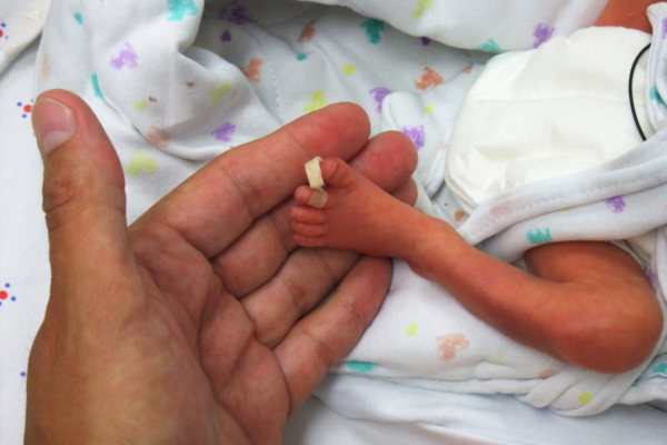 Le CHU de Martinique lance un appel aux dons de lait maternel pour les bébés prématurés