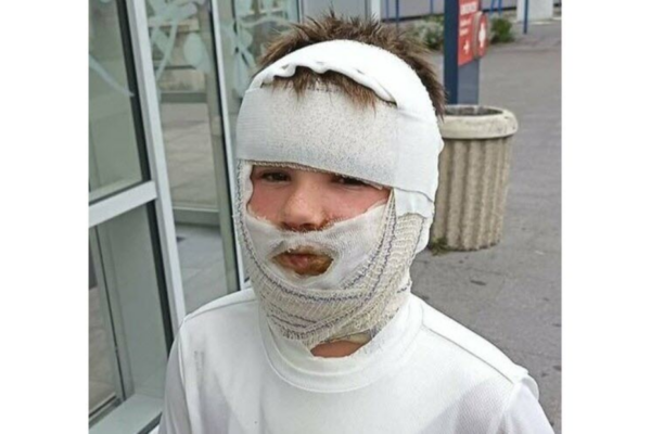 Pas-de-Calais : un enfant grièvement brûlé après l’explosion d’une balle antistress achetée en magasin